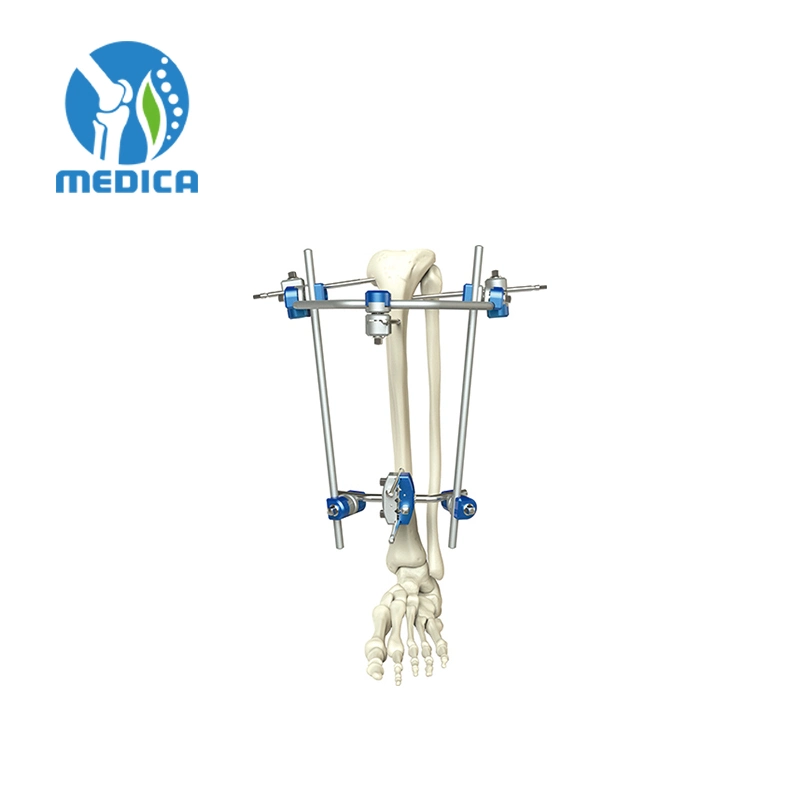 Orthopedic Trauma External Fixation Cross Connecting Plate Joint for Ring Shaped Fixators