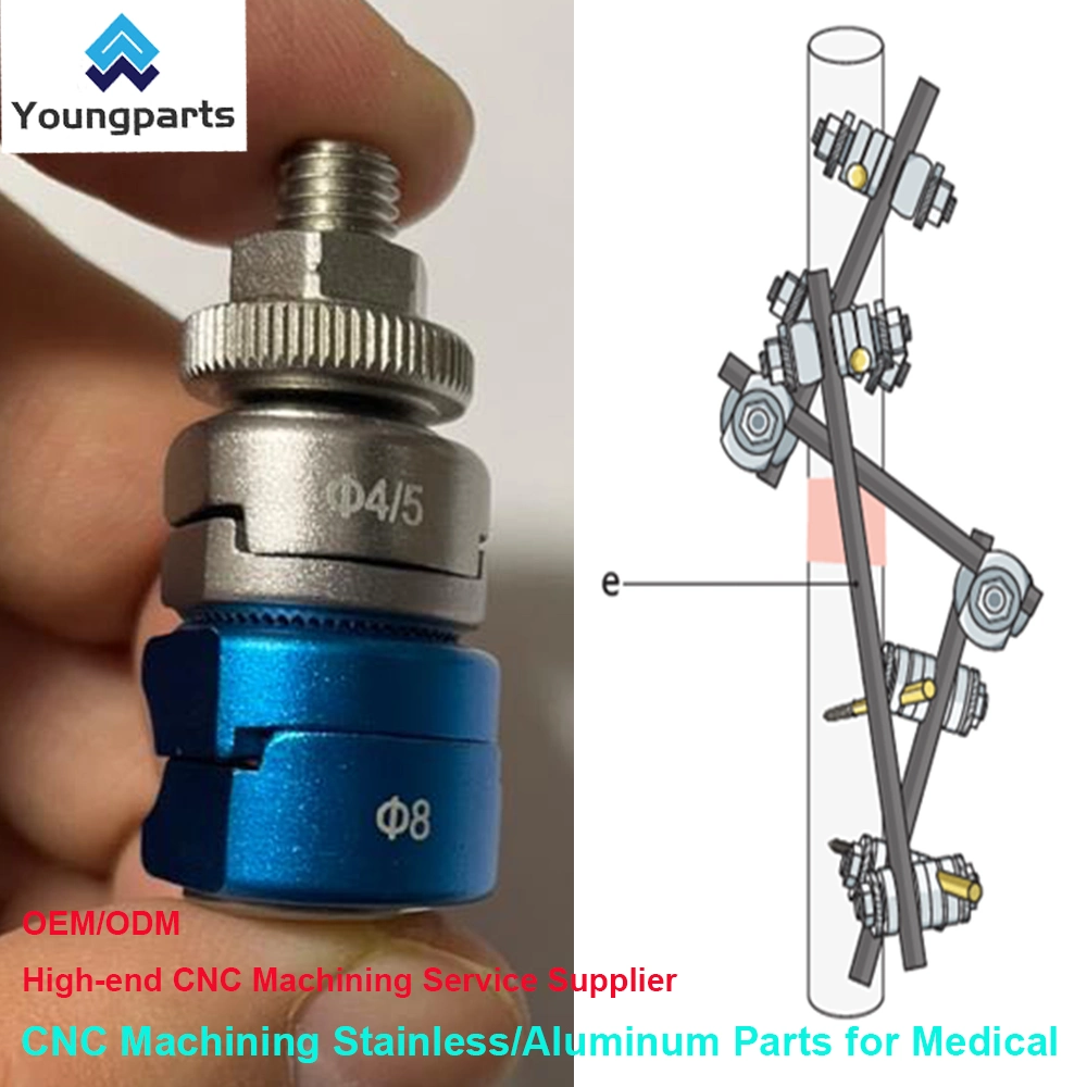 Bone Screws: Reliable Fastening Devices for Orthopedic Surgeries