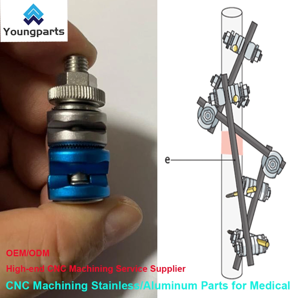 Bone Screws: Reliable Fastening Devices for Orthopedic Surgeries