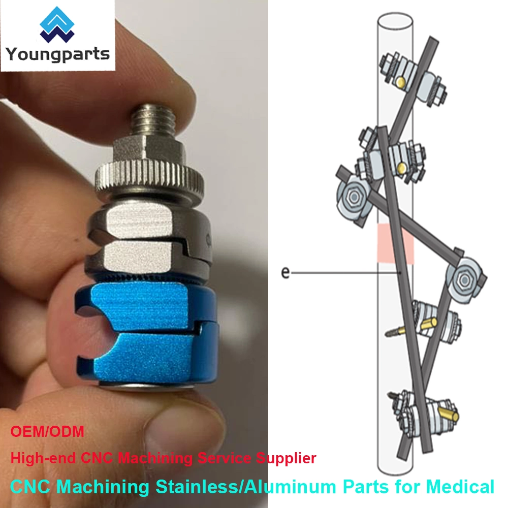 Bone Screws: Reliable Fastening Devices for Orthopedic Surgeries