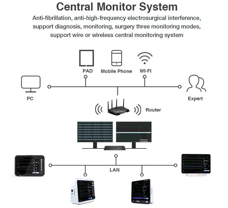 2024 New Portable 12.1inch Screen Patient Monitor for Hospital