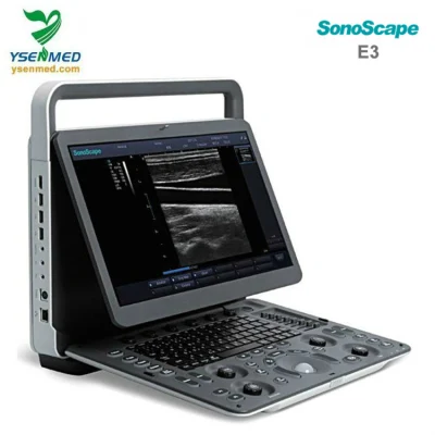 Factory Price Sonoscape E3 Digital Color Doppler Laptop Ultrasound Machine