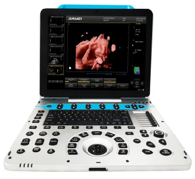  Dw-P30 Portable 4D/5D Color Doppler Ultrasound Machine