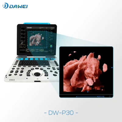  Dw-P30 Dawei Brand 3D/4D/5D Ultrasound Machine