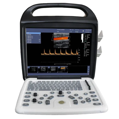 Portable Laptop Color Doppler Ultrasound Machine