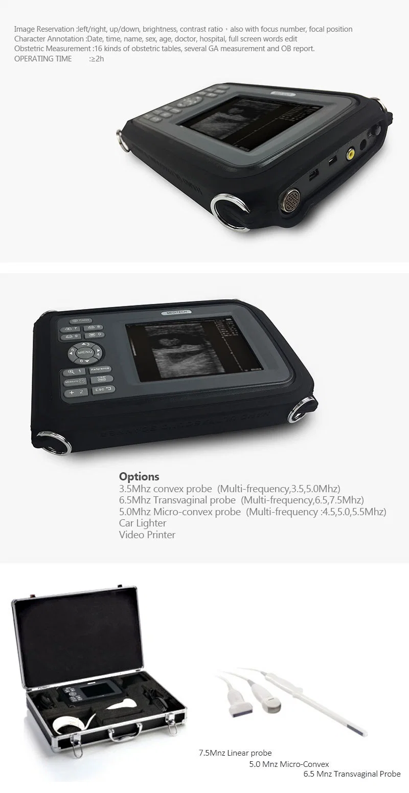 Color Display, Portable RFID Veterinary Ultrasound Machines