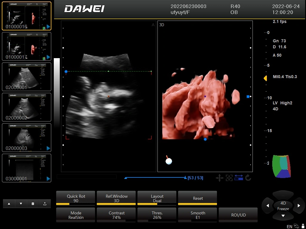 Dw-P30 Dawei Brand 3D/4D/5D Ultrasound Machine