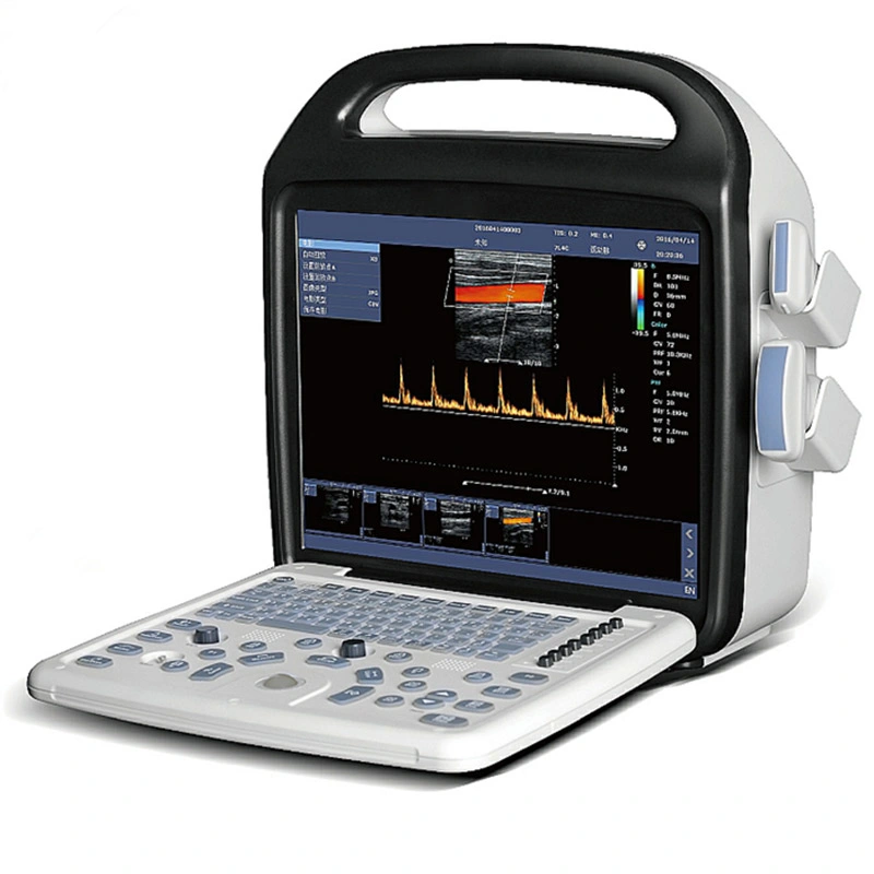 Portable Laptop Color Doppler Ultrasound Machine