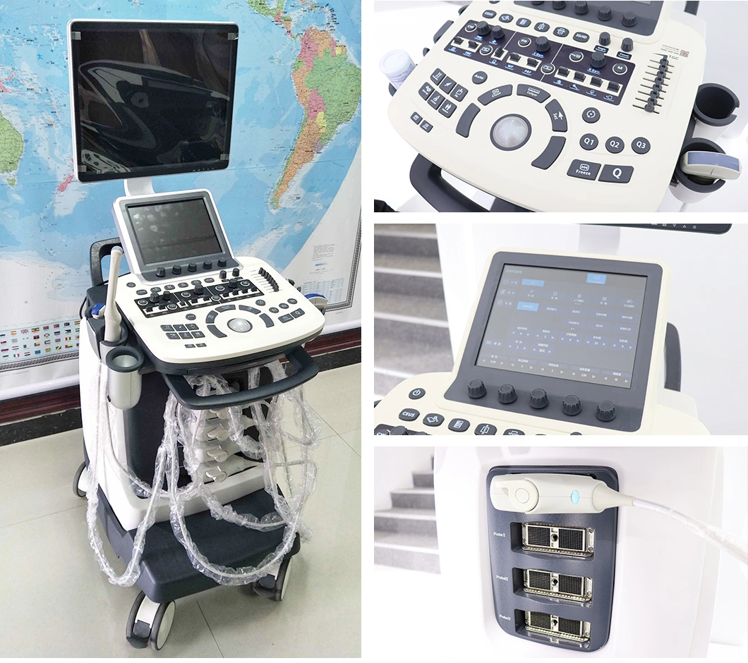 Medical High Resolution 10.4 Inch Touch Screen 3D 4D Trolley Color Doppler Ultrasound Machine