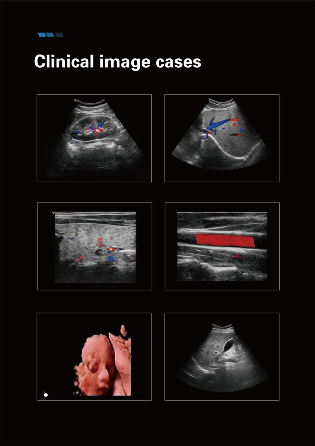 Dw-P30 Portable 4D/5D Color Doppler Ultrasound Machine