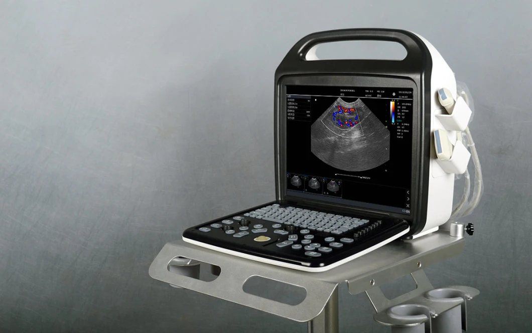 Portable Laptop Color Doppler Ultrasound Machine