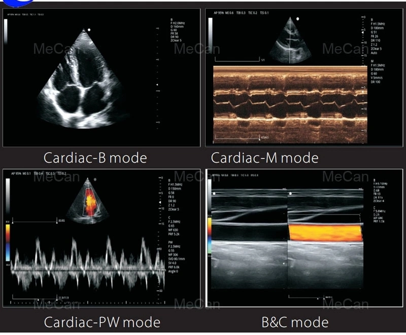 Trans-Vaginal Probe Scanner Veterinary Portable Welld Ultrasound Machine with High Quality MCU-CD001