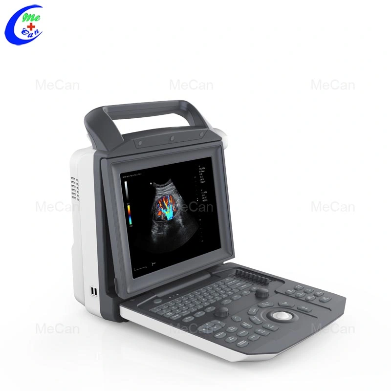 Linear Array Cardiovascular Wireless USG Probe Android Ultrasound Machine MCU-CD001