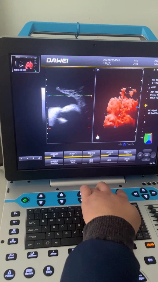 Dw-P30 Dawei Brand 3D/4D/5D Ultrasound Machine