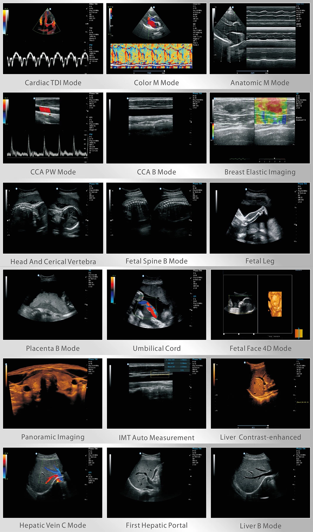 Medical High Resolution 10.4 Inch Touch Screen 3D 4D Trolley Color Doppler Ultrasound Machine