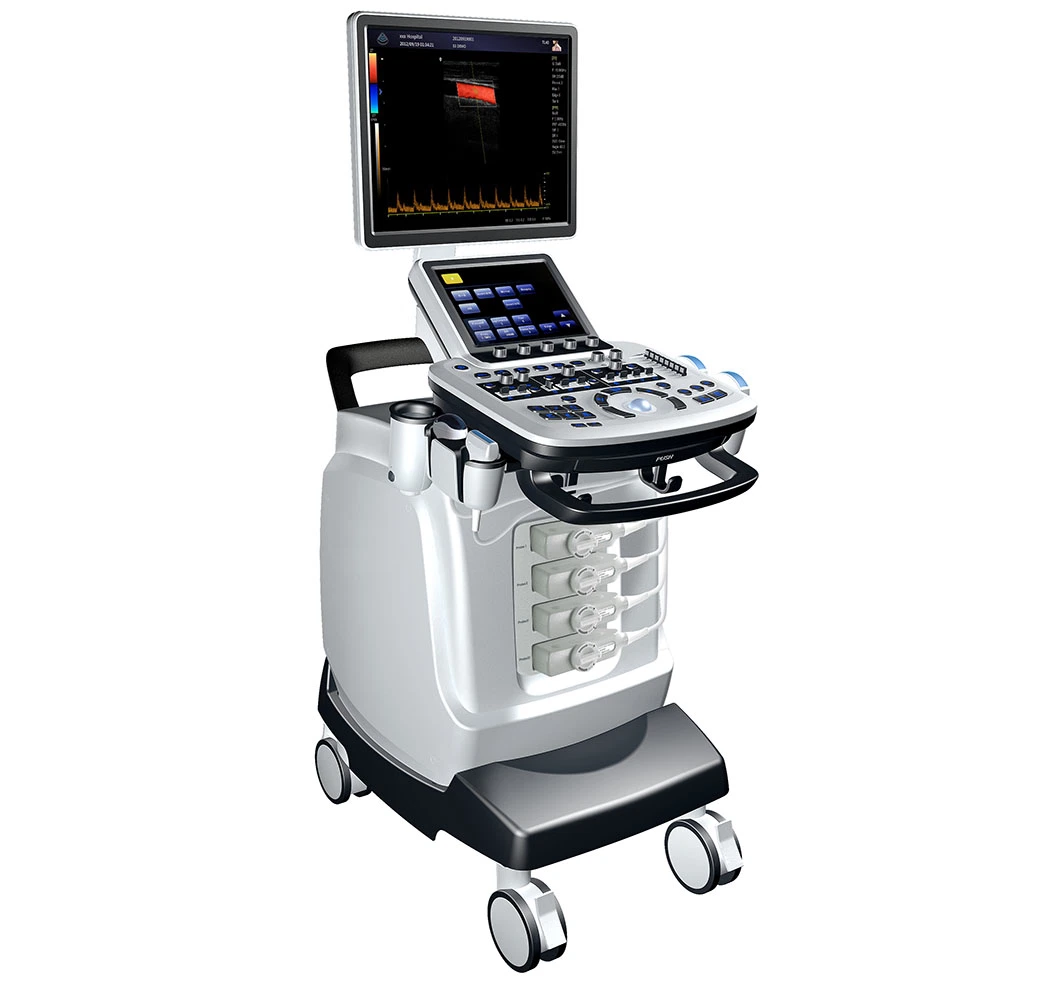 Medical High Resolution 10.4 Inch Touch Screen 3D 4D Trolley Color Doppler Ultrasound Machine