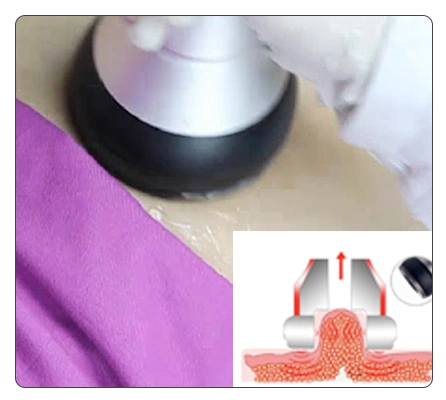 Ce Authentication Facial Beauty RF Microneedle Rejuvenation Multipolar Radio Frequency for Skin Care