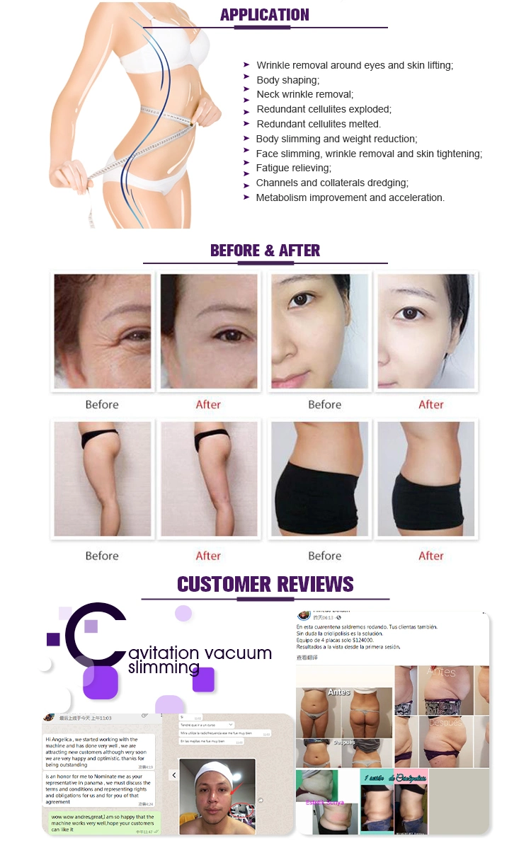 Ce Authentication Facial Beauty RF Microneedle Rejuvenation Multipolar Radio Frequency for Skin Care