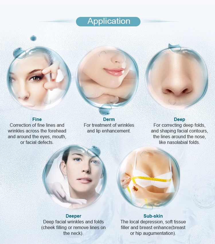 Authentication Safe Injectable Sodium Remove Wrinkles Nasolabial Folds Hyaluronate Acid Dermal Filler