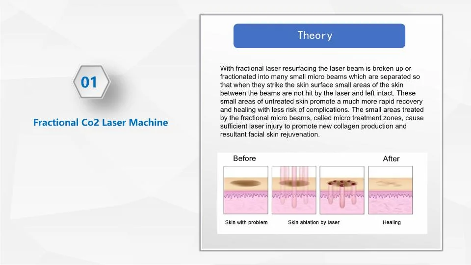 Stretch Marks Removal CO2 RF Laser Machine Scar Removal Fractional CO2 Laser