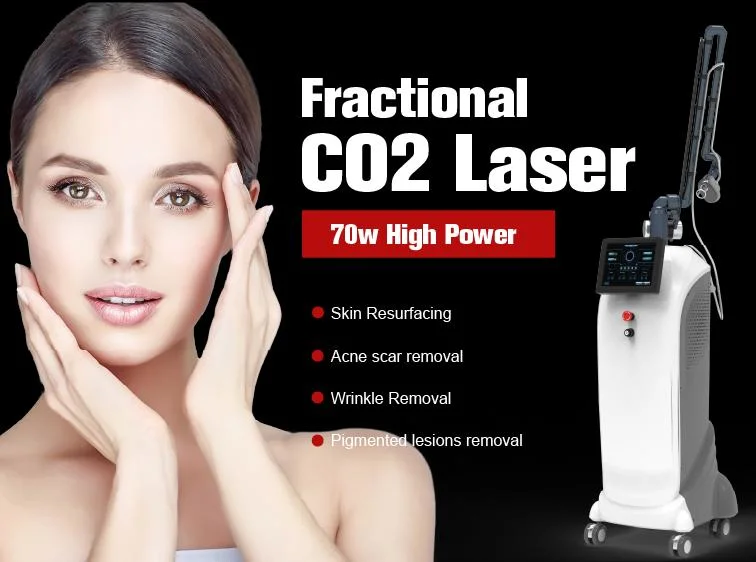 Black Nevus Basal Cell Carcinoma Actenic Keratoses Acne Burnt Venus CO2 Stretch Marks Laser Removal Machine for Salon