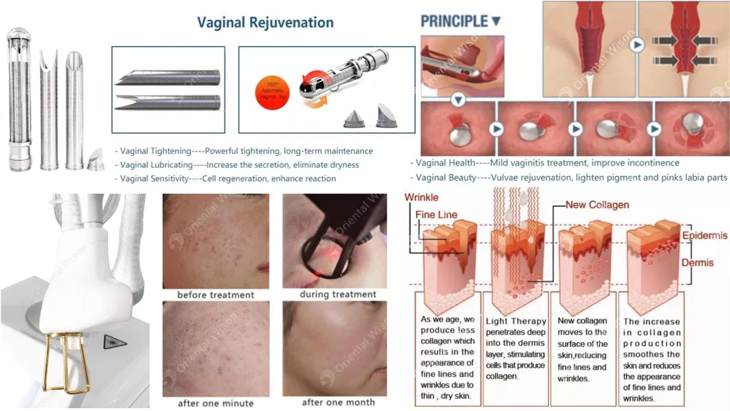 Medical CO2 Fractional Laser Equipment Spot Stretch Mark Removal Vagina Tightening CO2 Laser Machine