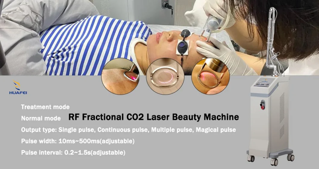 Fractional CO2 Laser Pigment Removal Skin Whitening Stretch Marks Removal Beauty Salon Machine