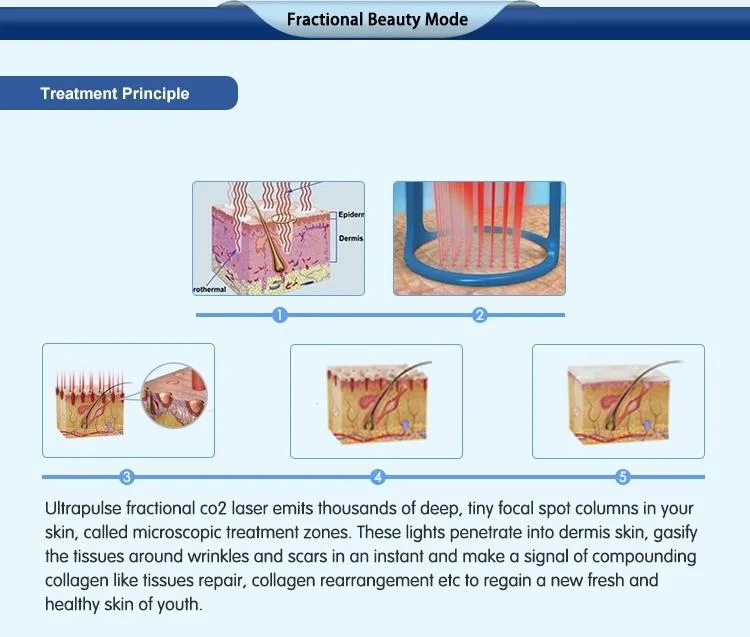 2022 New Fractional CO2 10600nm Laser Skin Rejuvenation Removal Scar Removal Stretch Marks and Moles Beauty Salon Equipment Laser Beauty Machine