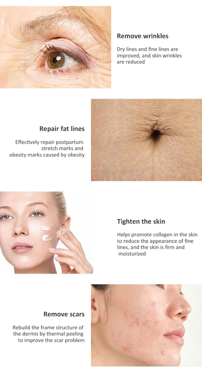 Beauty Fractional CO2 Laser Skin Resurfacing Machine Stretch Marks Acne Removal Vaginal Tightening CO2 Fractional Laser Machine Beauty Equipment