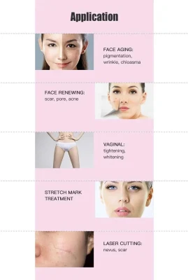 2023 CE Professional Salon Use Scar Removal Laser CO2 Fractional Лазерный CO2 Портативный станок для удаления растяжек