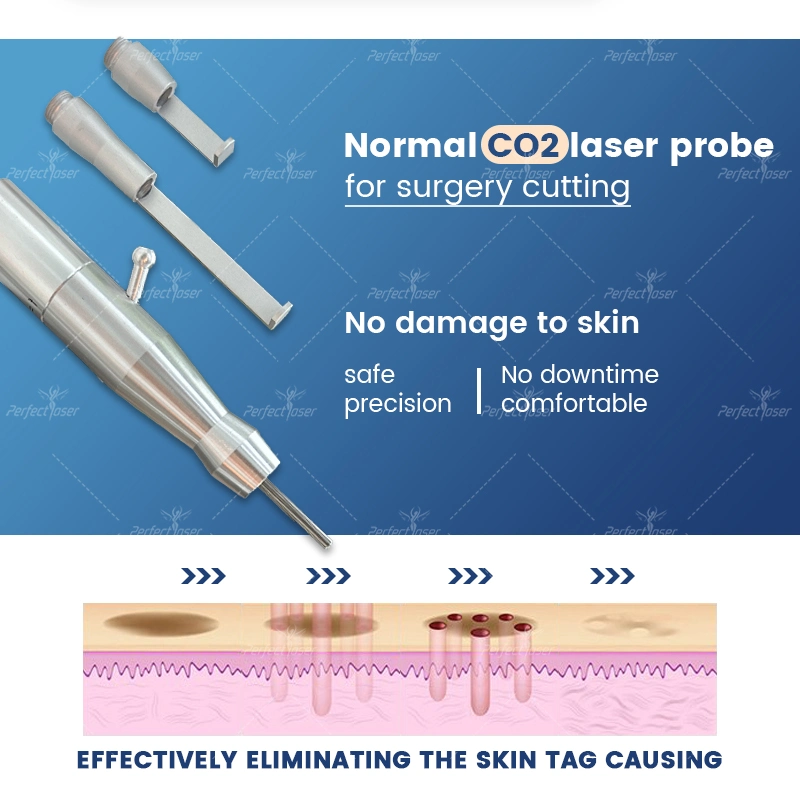 CE/FDA/RoHS CO2 Laser Vagina Rejuvenate Skin Care Tight Surgery Stretch Mark Removal Scar Treatment Femilift Professional Laser Cutting Machine