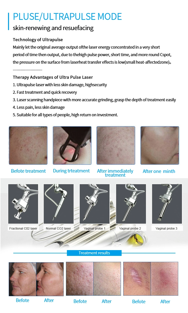 Face a Keloid Scar Pimple Fractional CO2 Laser Stretch Marks Acne Removal Machine