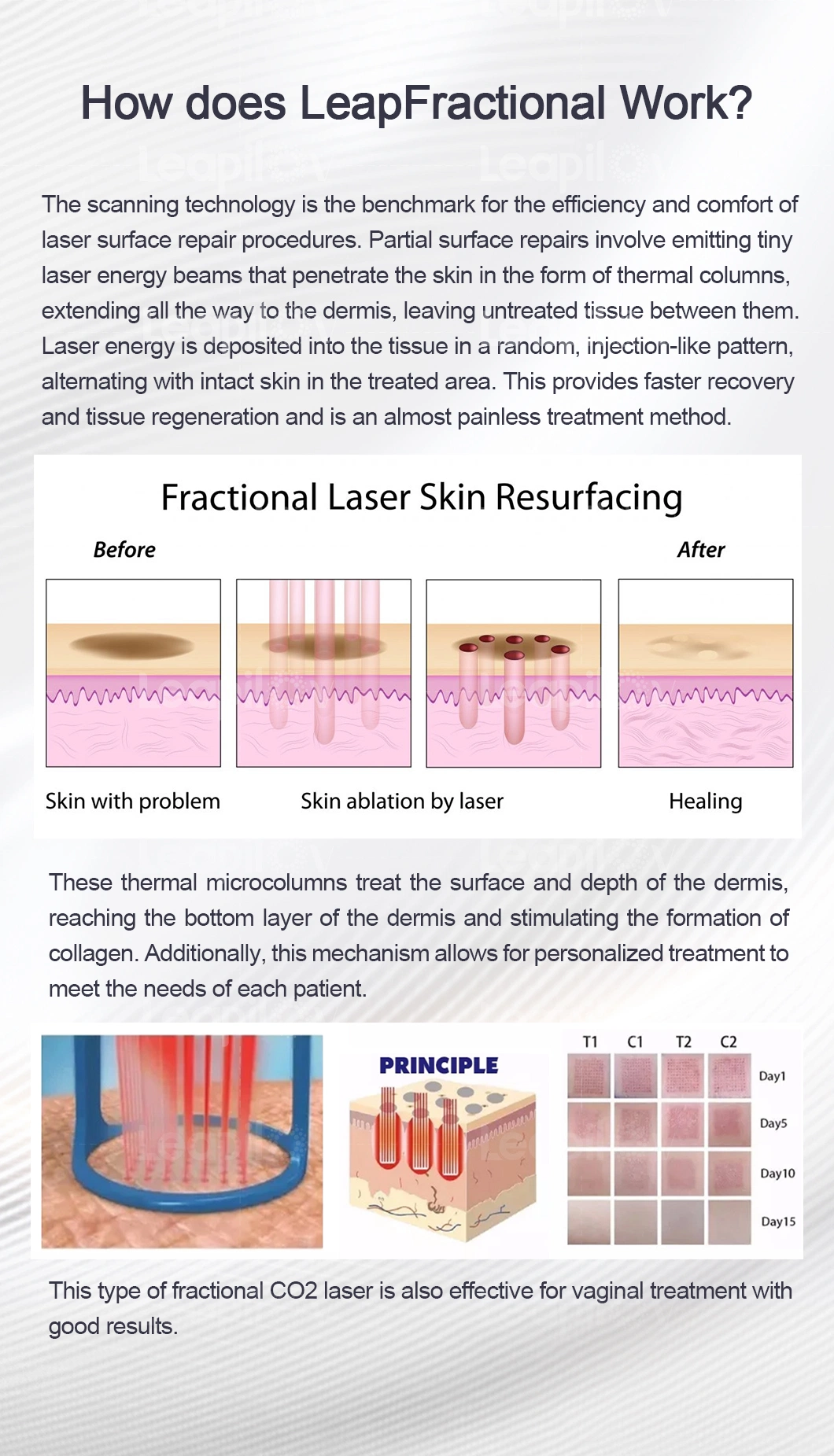 CE Fractional CO2 Laser Wrinkle Removal Pigmentation Stretch Mark Resurfacing Beauty Machine