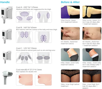 Raffreddamento a LED raffreddamento a forma di liquido riscaldamento Cellulite Cryo 4 gestisce il congelamento dei grassi Macchina per lo scultore del corpo