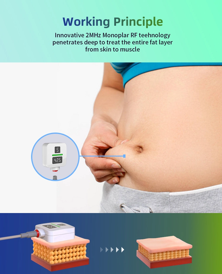 Hot Sale RF Technology Trusculpt Burn Fat Deep Monopolar RF Sculptor