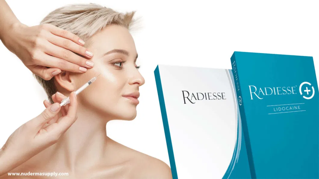 Radiesse Volassom Facetem Korean Filler Calcium Hydroxyapatite Filler for Wrinkle Removal