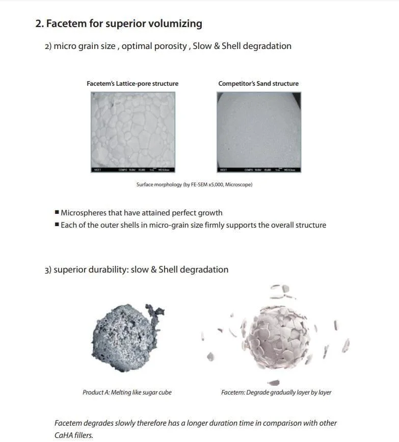 Radiesse Volassom Facetem Korean Filler Calcium Hydroxyapatite Filler for Wrinkle Removal
