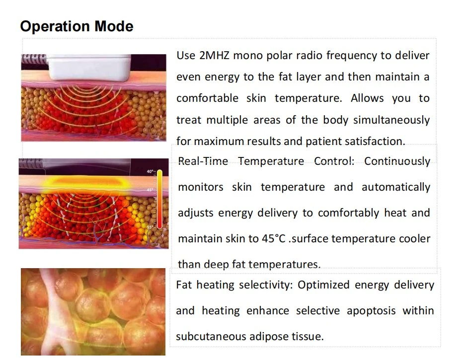 Monopolar RF Trusculpt ID 3D Flex Body Contouring Cellulite Reduction with 8 Handles