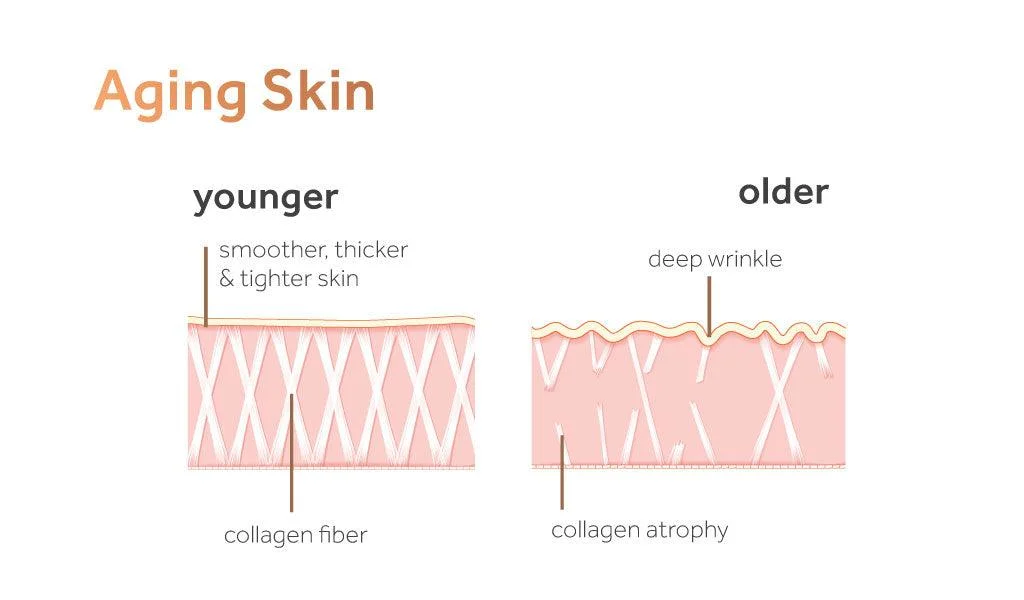 Otesaly Baby Collagen Injection SPA Skin Booster Mesotherapy Skin Rejuvenation Skin Brightening Solution