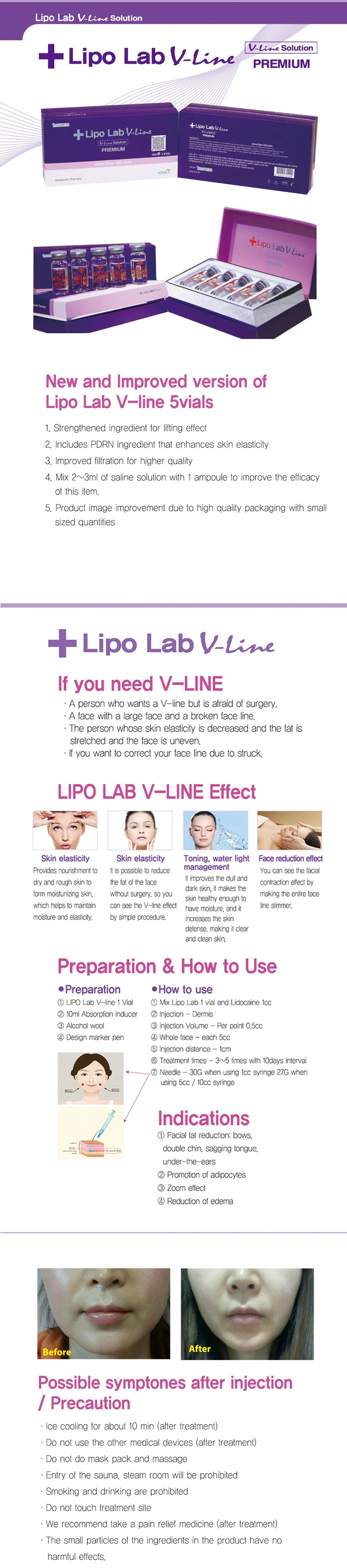 2020 New Lipo Lab Vline, High Safety, Quick Effect, Small Side Effects, Rapid Shaping Injectable for Dissolve Jaw Line Fat Solution