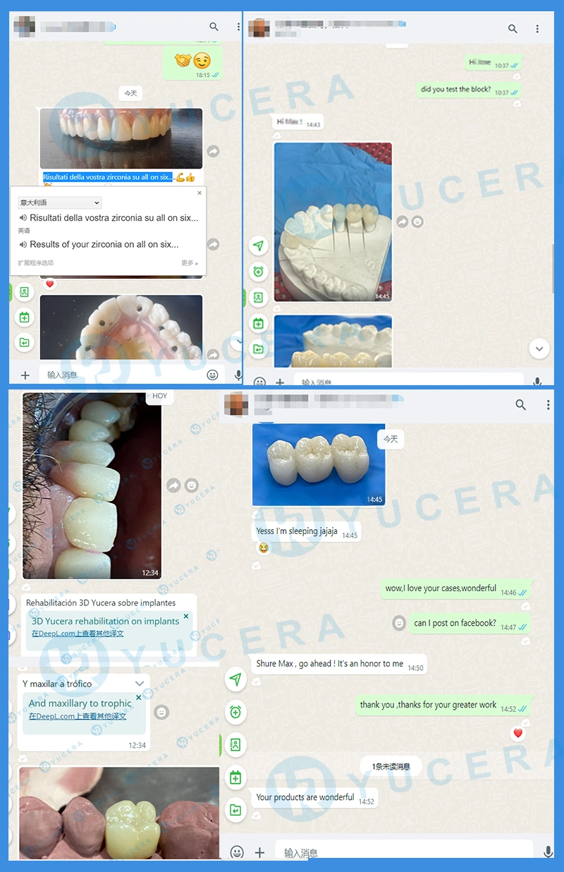 Yucera 3D Plus Multilayer Zirconia Blocks for Aesthetic Outcomes