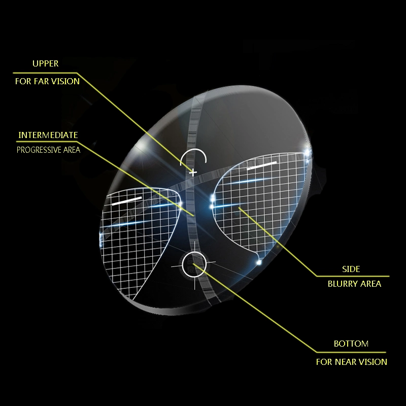 Sf 1.56 Progressif Multifocal Anti-Reflective Optical Lens