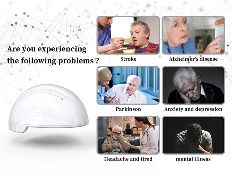 Traumatic Brain Injury Treatment Neurofeedback Physiotherapy PDT Machine 810nm LED Phototherapy Photodynamic Therapy Brain Photobiomodulation Wearable Equipment