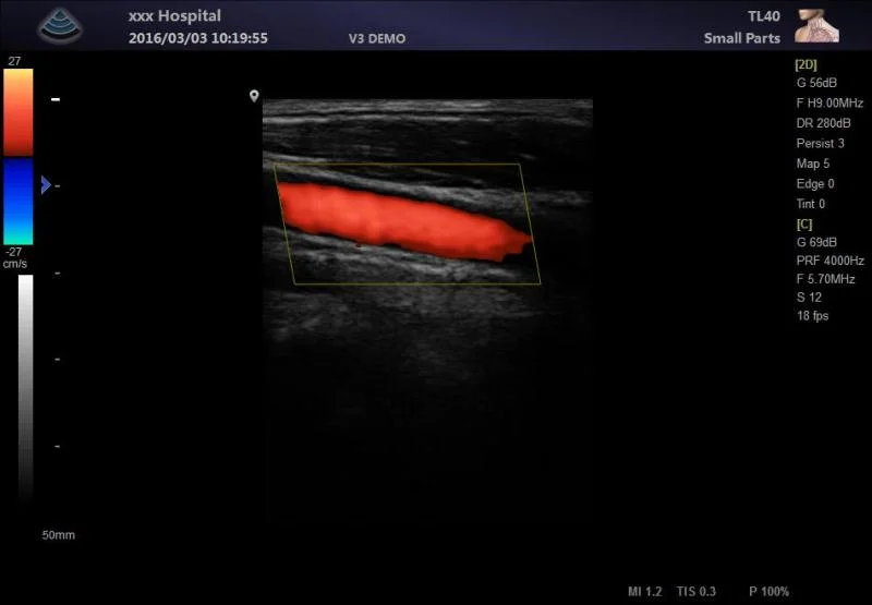 Ltub62V Portable Ultrasound Scanner Full Digital Machine for Veterinary