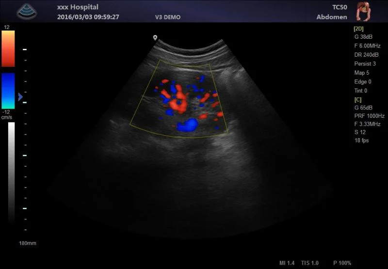 Ltub62V Portable Ultrasound Scanner Full Digital Machine for Veterinary