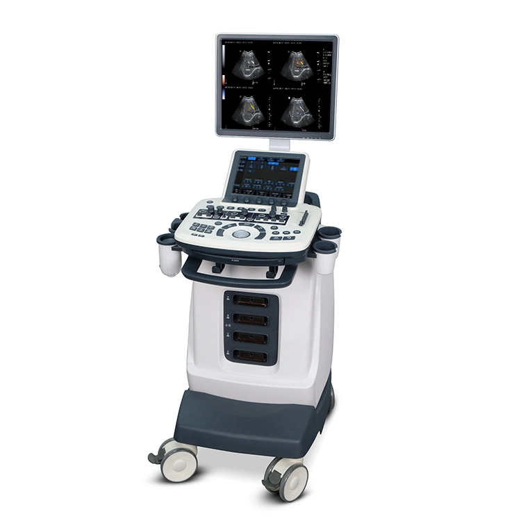 Ysb-S7 Hospital Medical Trolley Color Doppler 4D Ultrasound