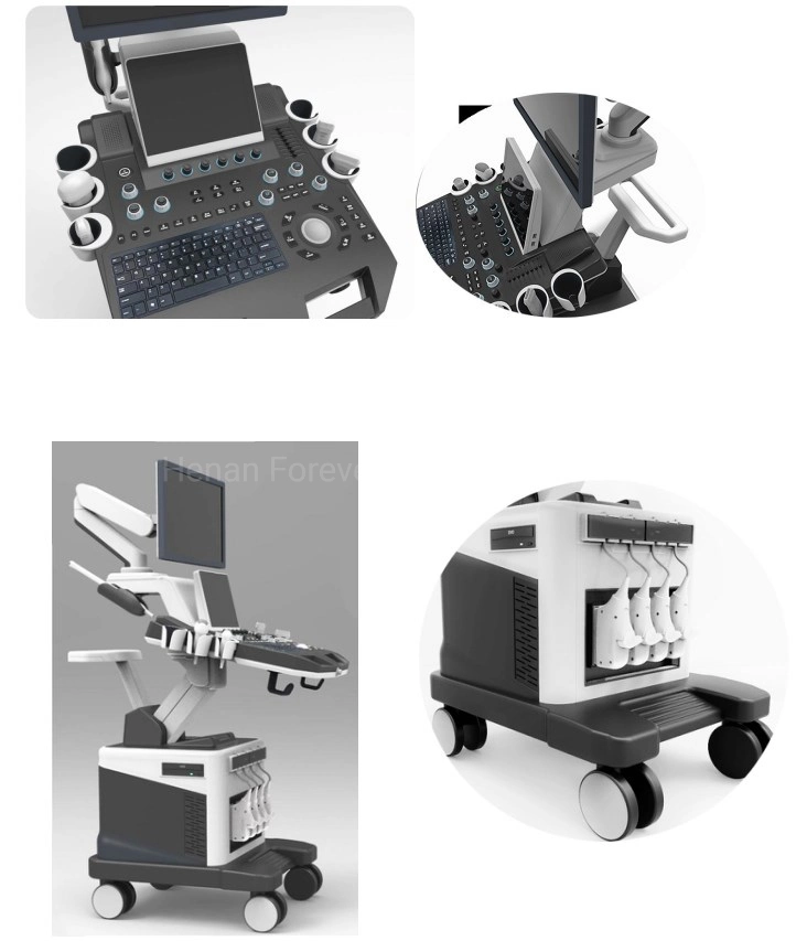 CE Ob&Gyn Medical USG Machine Trolley Ultrasound Scanner