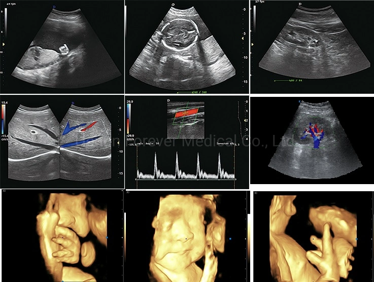 CE Ob&Gyn Medical USG Machine Trolley Ultrasound Scanner