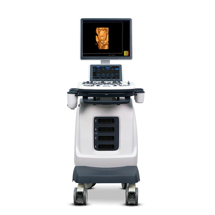 Ysb-S7 Hospital Medical Trolley Color Doppler 4D Ultrasound