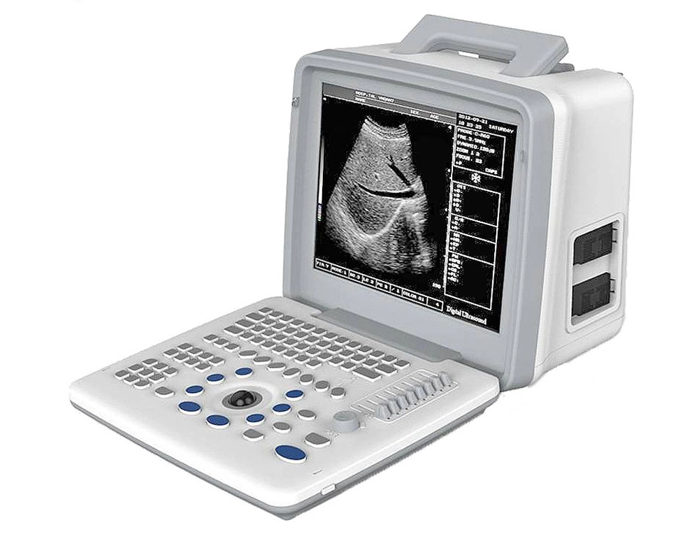 Ltub62V Portable Ultrasound Scanner Full Digital Machine for Veterinary